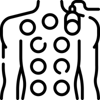 Hijamah